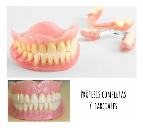 Imagen 3 de 5 de Reparación De Prótesis En El Acto