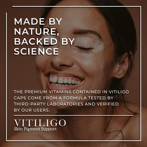 Support (vitiligo-skin Pigment Antioxidants Inmune 60 Cps