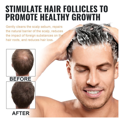 Shampoo Para Acelerar El Crecimiento Del Cabello