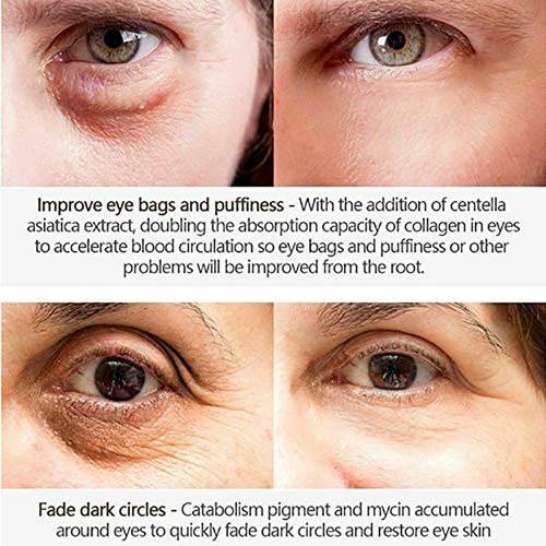 Crema Para Ojos Con Veneno De Serpiente Para Eliminar Ojeras