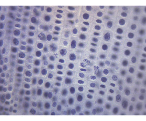 Mitosis De Cebolla Eisco, Portaobjetos De Microscopio Prepar