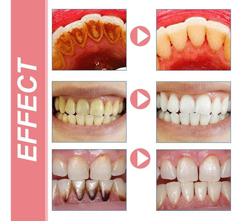 - Pasta De Dientes Sp8 Probiotics Bright White, Fresh Breath