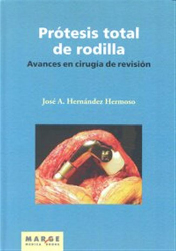Protesis Total De Rodilla - Hernandez Hermoso,jose A,
