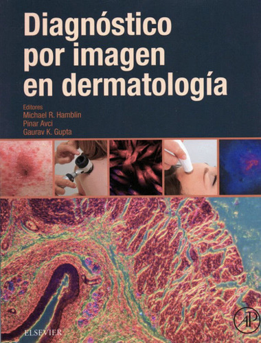 Diagnostico Por Imagen En Dermatologia