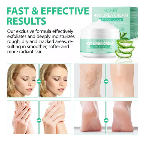 W Urea 40% Crema De Urea Cream Hidratante