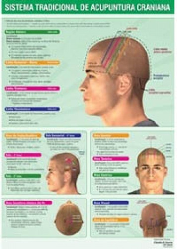 Mapa Sistema Tradicional De Acupuntura Craniana