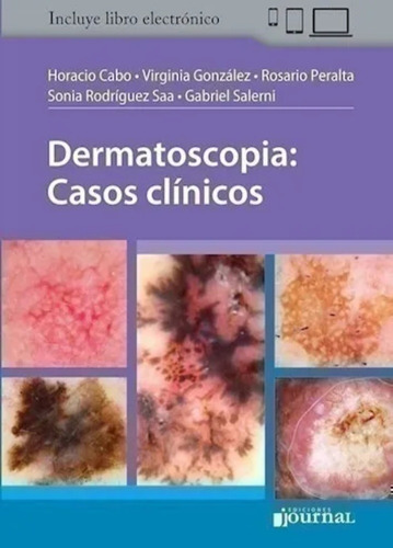Dermastocopia : Casos Clinicos