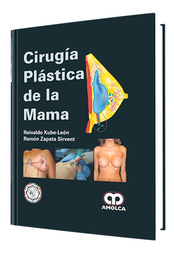 Cirugía Plástica De La Mama. Libro De Medicina.