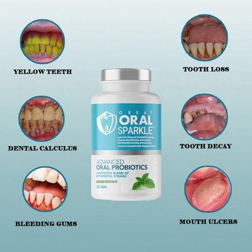 Tabletas Pasta De Dientes Probióticas, Blanqueamiento Dental