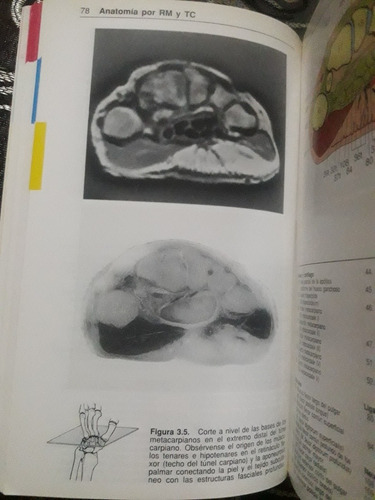 Libro Atlas Anatomia Por Tc Y Rm De J. Bloem Y D. Sartoris (Usado)