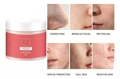 Kyl Crema Blanqueadora Y Exfoliante Azucar Glow