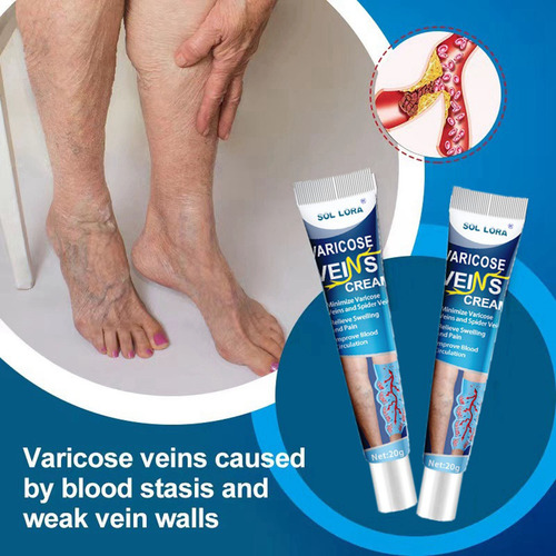 L Varicose Veins Cream Vein Ointment Nanovein Cream Against