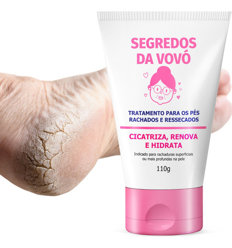 Creme Pé Rachaduras Combate E Remove Fissuras No Calcanhar