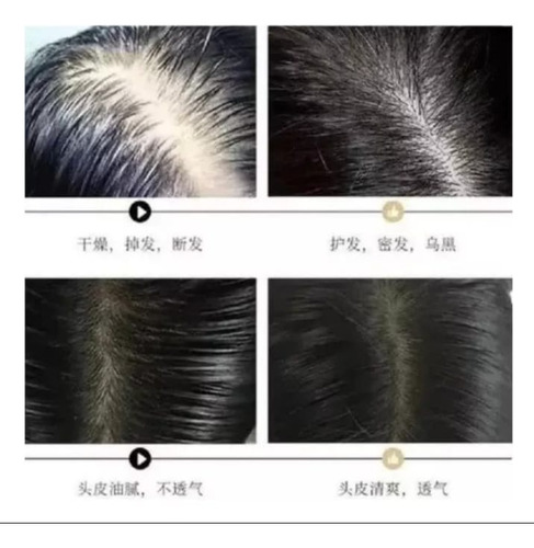 2 Shampoo Reparador Raíz Jengibre Anticaída Crecimiento