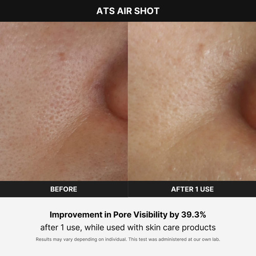 Dispositivo Para Cuidados Com A Pele Medicube Age-r Arts Air