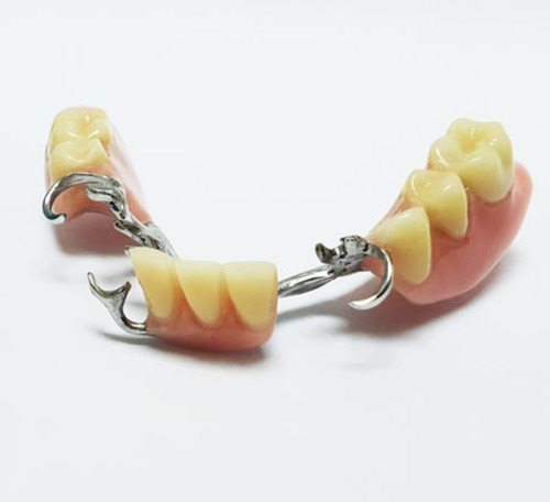 Imagen 4 de 5 de Dentista Mecanico Dental Protesis Implantes Dentales