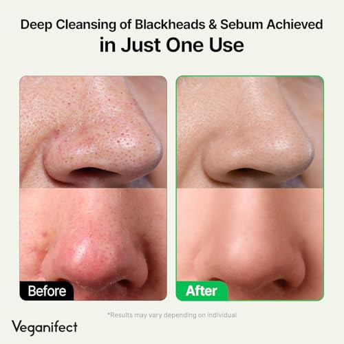 Aceite De Limpieza Profunda Lha Maquillaje Removedor De Punt