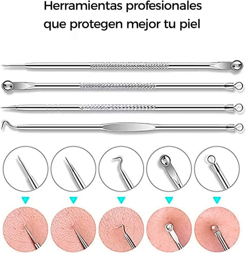 Removedor Extractor Puntos Negros Acné Espinilla Kit 4pz
