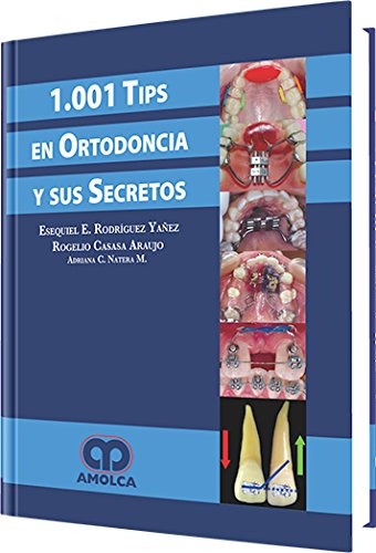 Libro 1001 Tips En Ortodoncia Y Sus Secretos De Esequiel Edu