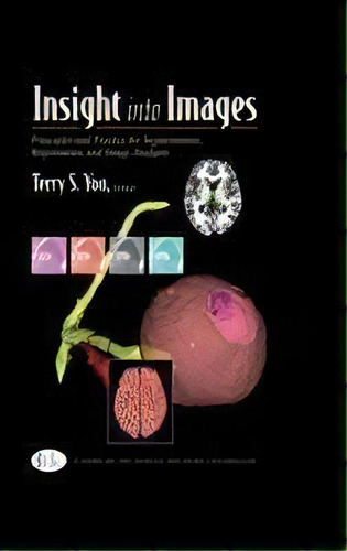 Insight Into Images : Principles And Practice For Segmentation, Registration, And Image Analysis, De Terry S. Yoo. Editorial Taylor & Francis Inc, Tapa Dura En Inglés