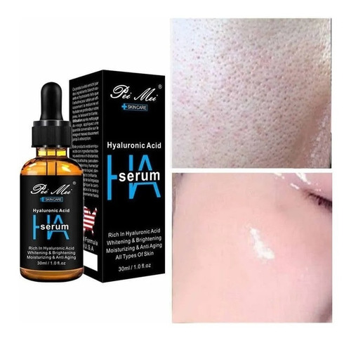 Imagen 1 de 2 de Acido Hialuronico Hidratante Cara Y Blanqueado 30ml