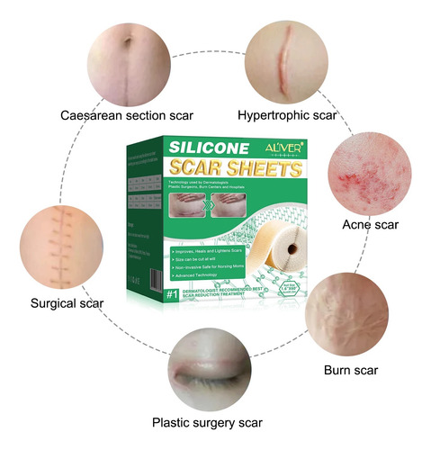 Parche Cicatrices Postoperatorio Silicona Rollo Quemaduras