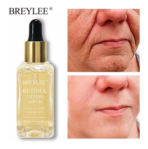 Retinol Antiarrugas