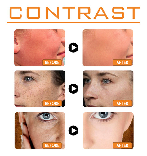 La Loción De Protección Facial Ouhoe Aísla Los Rayos Uv Y An