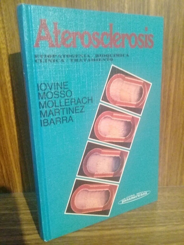 Aterosclerosis