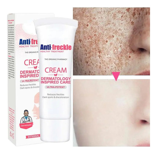 Crema Blanqueadora Para Pecas Que Elimina Las Manchas Oscura