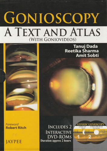  Volver A Resultados Gonioscopy: A Text And Atlas (with Gon