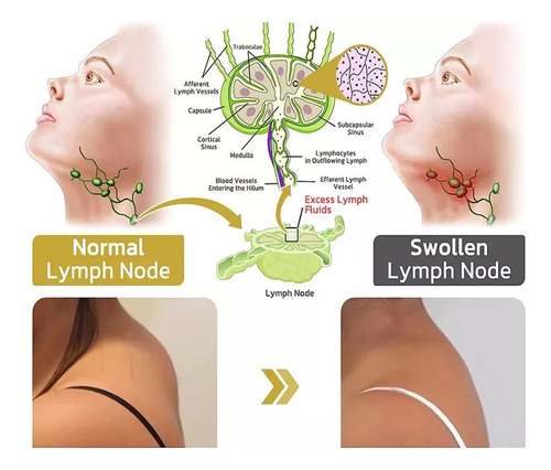 Perfecto 4 Pendientes De Germanio Halolux Lymphvity,