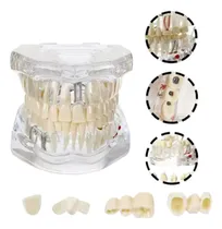 Comprar Maqueta Didáctica De Patologías Y Tratamientos Dental