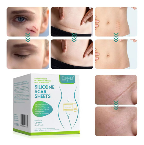 Parche De Silicona For Cicatrices, Rollo De Cinta, Tira,