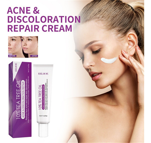 Crema X Azelaic, 10% Azelaic Booster Healing, Para Rostro Y