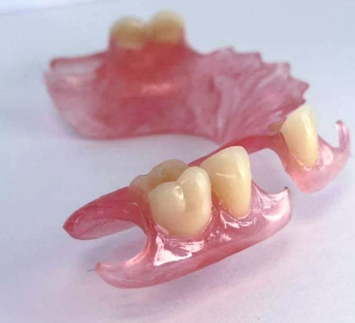 Imagen 1 de 5 de Prótesis Dentales Dentista A Domicilio,o Consul En 4 Días !!