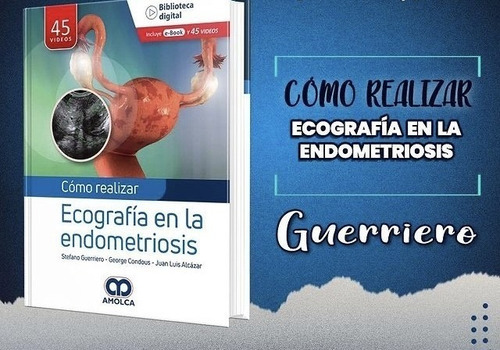 Como Realizar Ecografía En La Endometriosis +e-book, De Stefano Guerreiro Y Otros., Vol. 1. Editorial Amolca, Tapa Dura, Edición 1 En Español, 2022