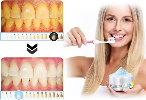 - Polvo Oral For Tratamiento Con Veneno De Abeja Focussmile