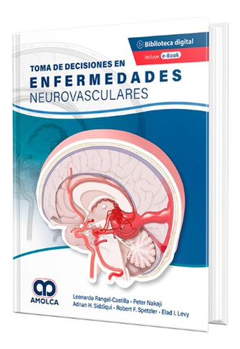 Toma De Decisiones En Enfermedades Neurovasculares.  E-book