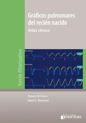 Graficos Pulmonares Del Recien Nacido Atlas Clinico