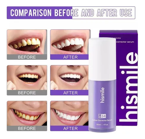 . 3 P De Crema Dental Branqueadora Hi-smile V34/repara