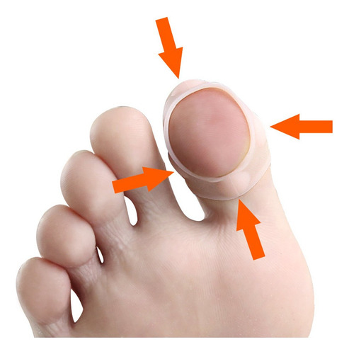 10 Pares De Fijador De Corrección De Uñas De Silicona Para