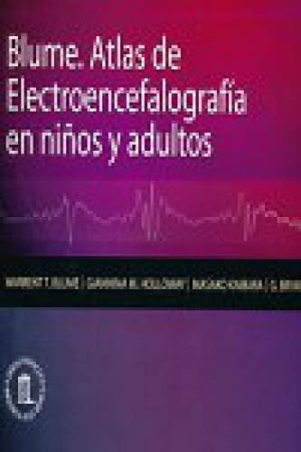 Libro Atlas De Electroencefalografía En Niños Y Adultos De W