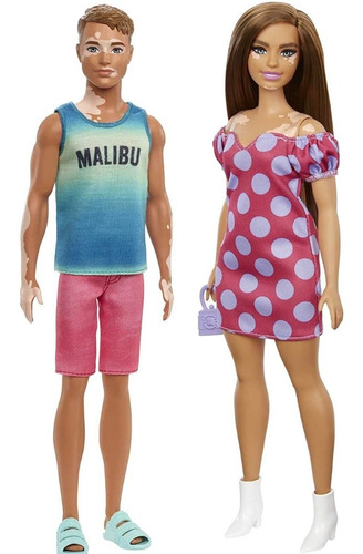 Muñecos Ken Y Barbie Fashionistas Vitiligo