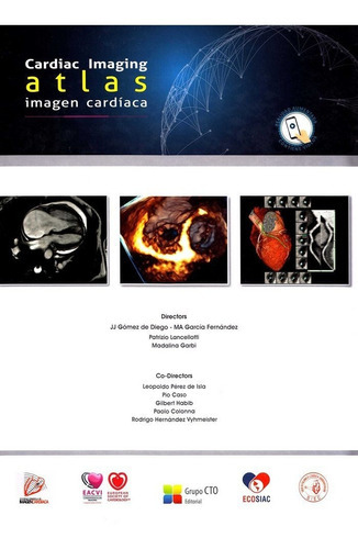 Atlas de Imagen CardÃÂaca-Cardiac Imaging Atlas, de VV. AA.. Cto Editorial Sl, tapa dura en inglés