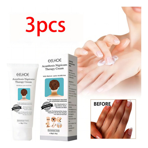 Fixderma Nigrifix Crema Para Acantosis Nigricans Agf, 3 Unid