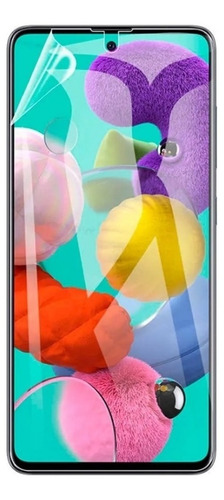 Hidrogel Protector De Pantalla Para Samsung S20 Fe