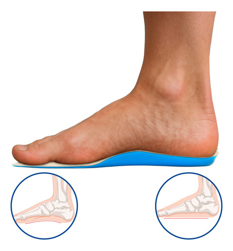 Plantilla Ortopedica Pie Plano Pelite C/barra Metatarsal Chico Largo Pie 23-25 Cm Beige Con Azul