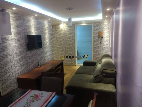 Imagem 26 de 30 de Ótimo Apartamento De 50m² Todo Reformado À Venda Na Chácara Santa Maria - Zona Sul De São Paulo/sp. Com 2 Dormitórios, Sala E 1 Vaga Por R$ 240 Mil. - Ap15957