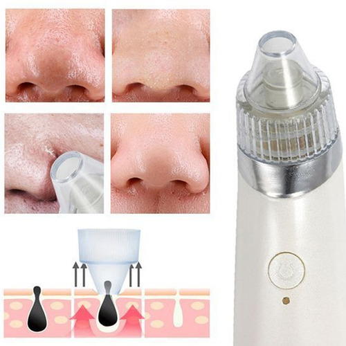 Aparelho Removedor Vacuo Peeling De Diamante Cravos Espinhas